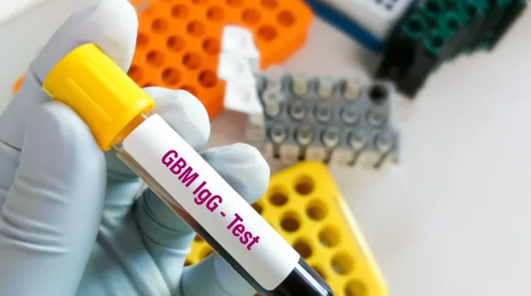 ganglioside gd1a antibody igg