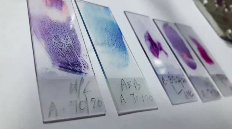 gram stain test