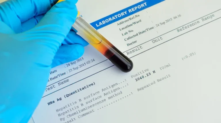 hbsag quantitative test