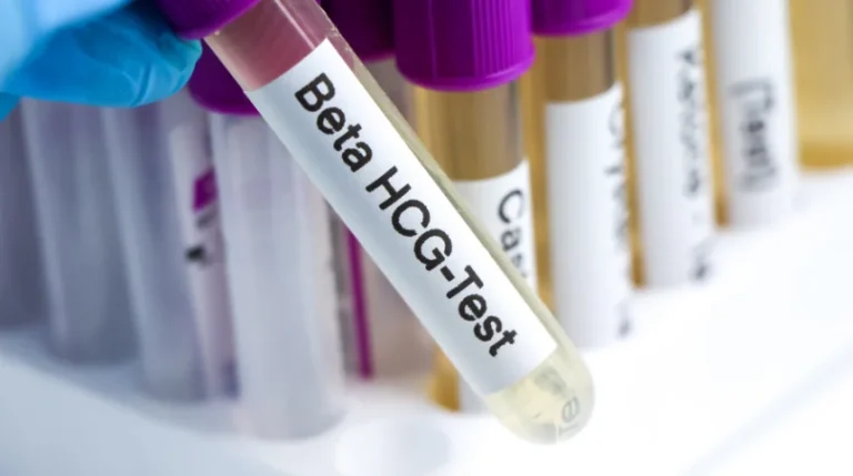 hcg tumor marker test