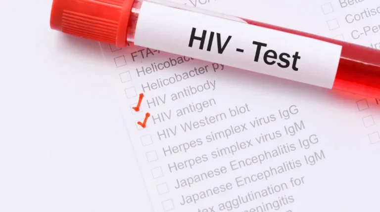hiv test