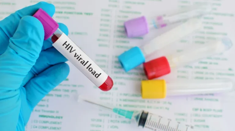 hiv viral load test