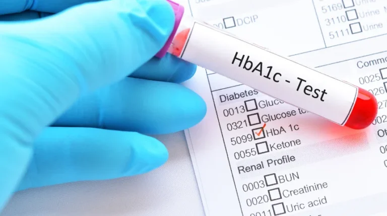 HbA1c Test | mediSuggest