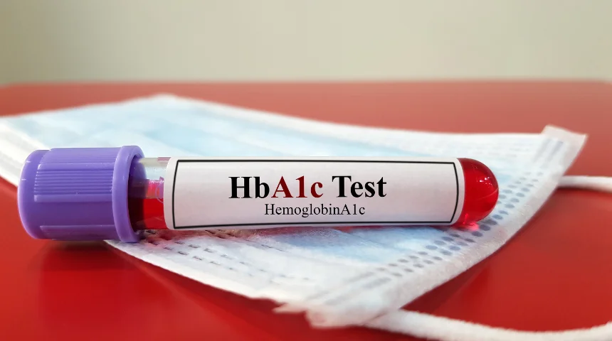 test