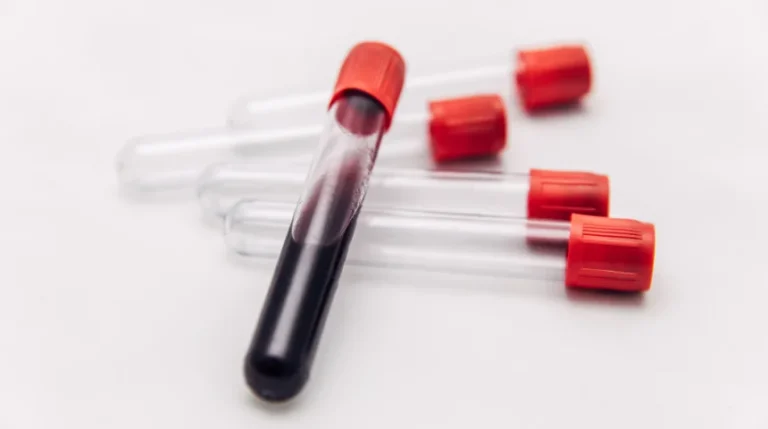 Heparin Anti Xa Test | mediSuggest