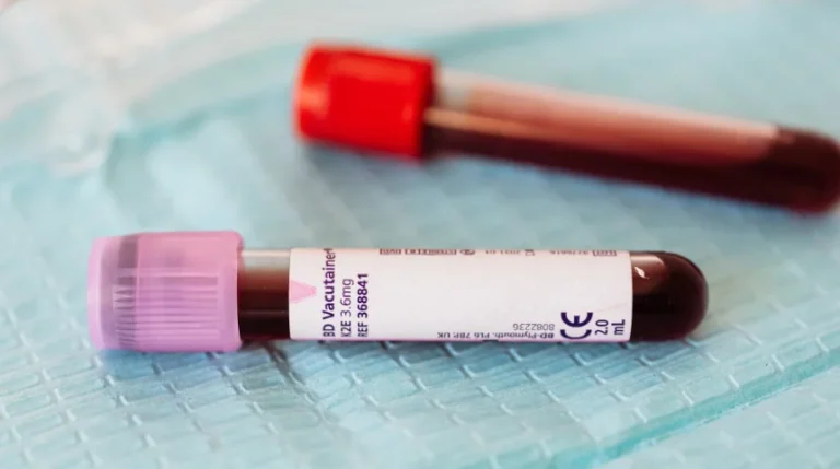 anti-hbc test