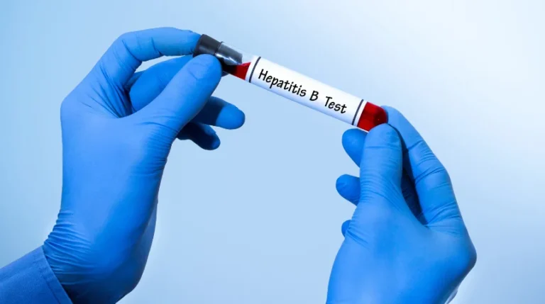 hepatitis b profile test