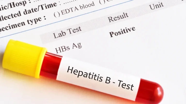 hepatitis b surface antibody test