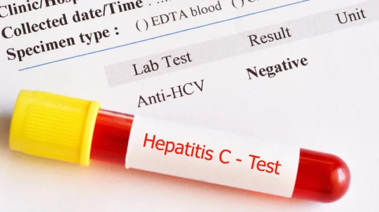 hepatitis c virus test
