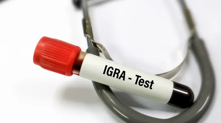 igra tb test