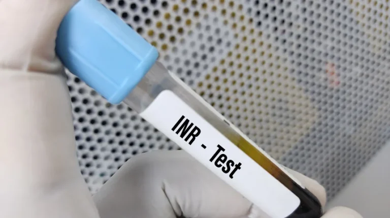 INR Test | mediSuggest