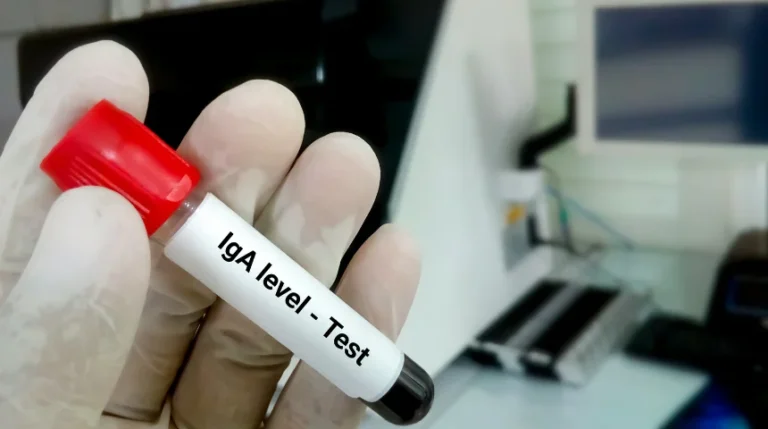 iga test