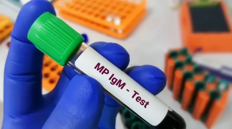 igm test