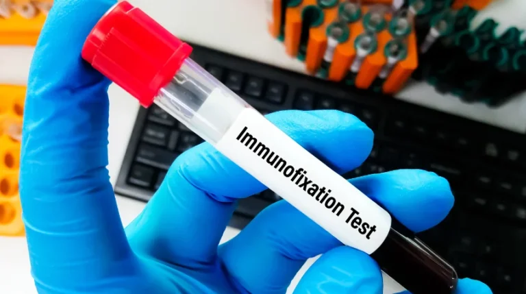immunofixation test