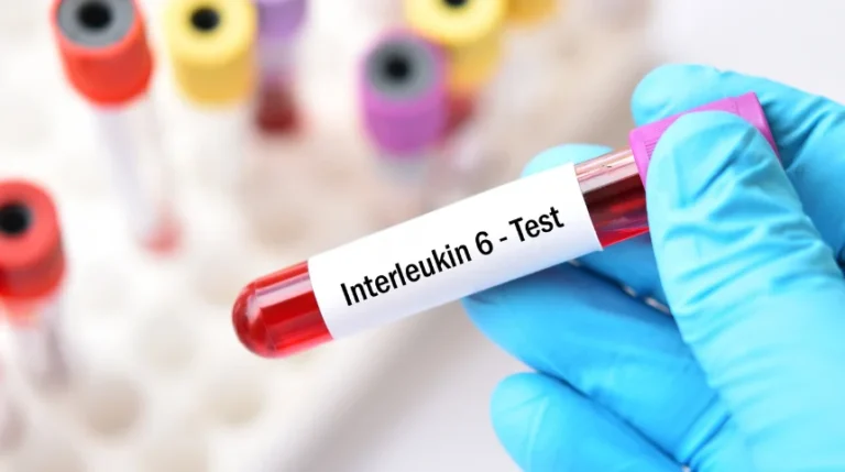 interleukin-6