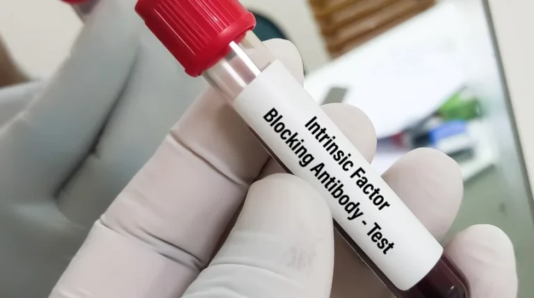 intrinsic factor antibody