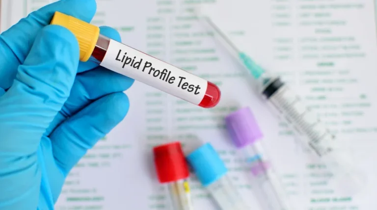 Lipid Profile Test | mediSuggest