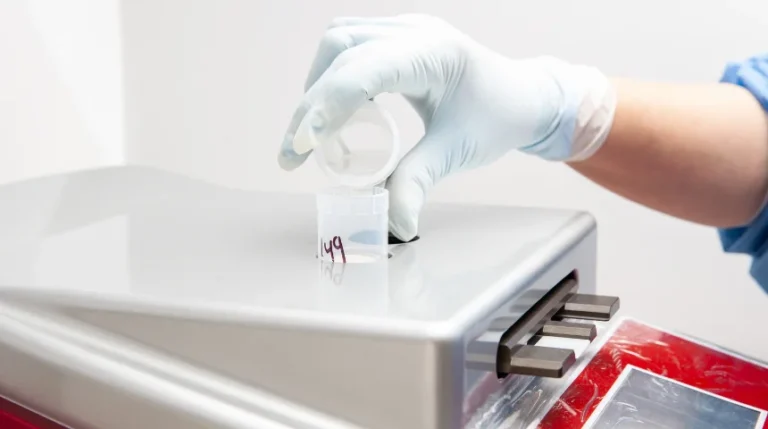 liquid-based cytology test