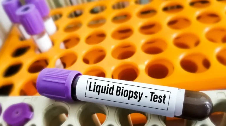 liquid biopsy test