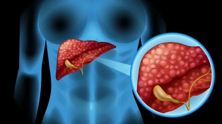 liver biopsy