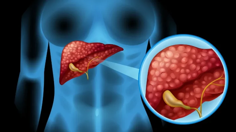 Liver FNA Test | mediSuggest
