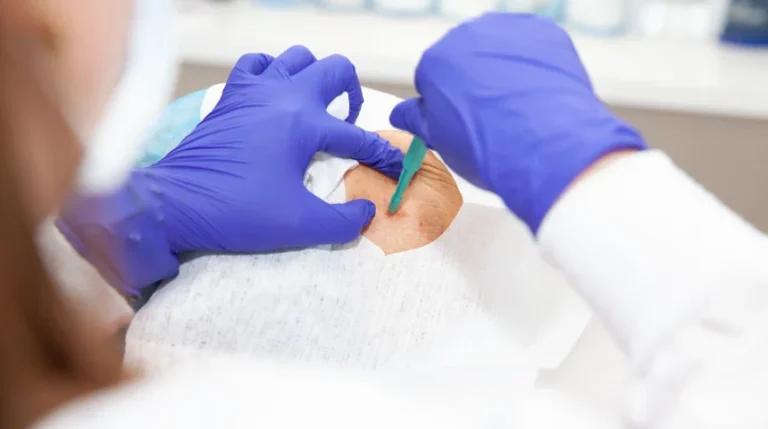 lung biopsy test