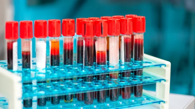 Lupus Anticoagulants Test | mediSuggest