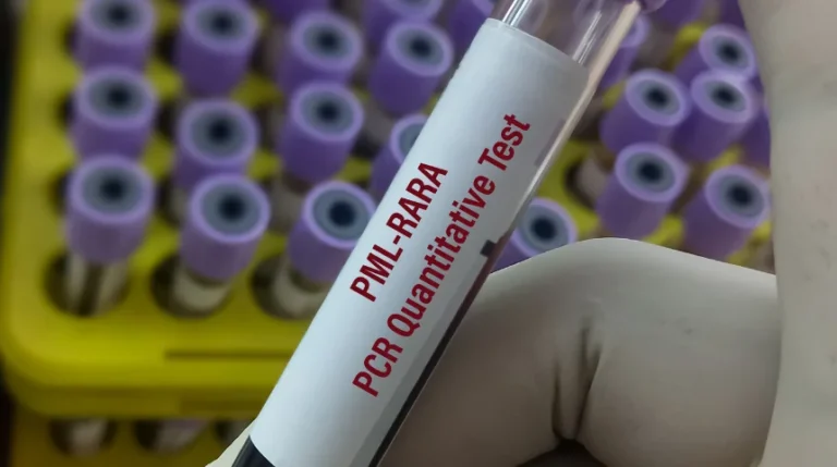 pml-rara test