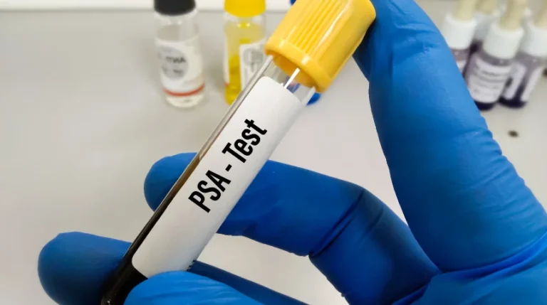 psa test