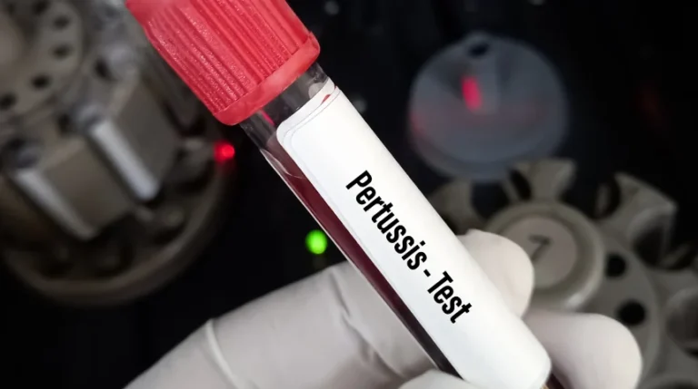 pertussis test