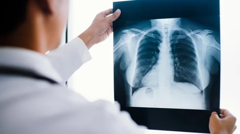 pleural fluid analysis