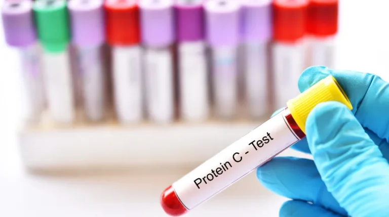 Protein C and Protein S Test | mediSuggest