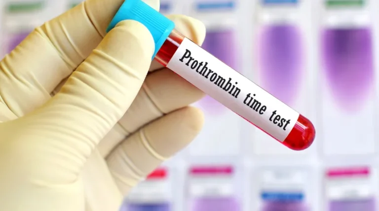 Prothrombin Time Test | mediSuggest