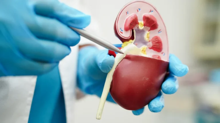 Renal FNA | mediSuggest