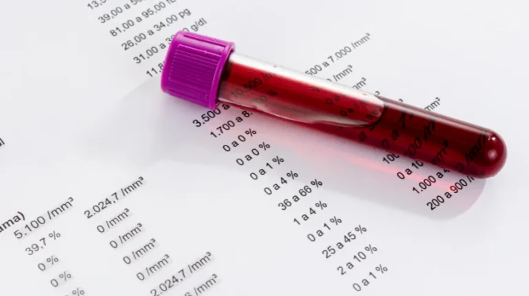 Retic Count Test | mediSuggest