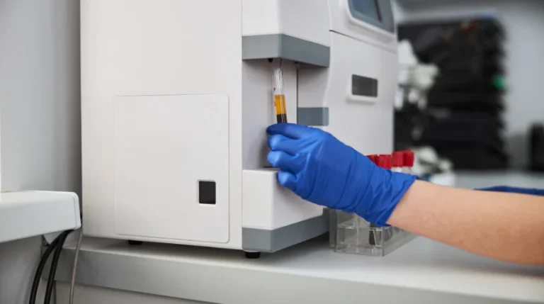 ribosomal p antibody test
