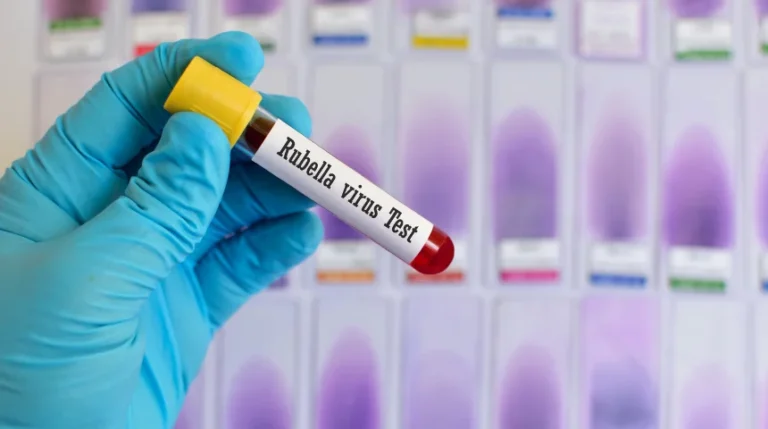 rubella test