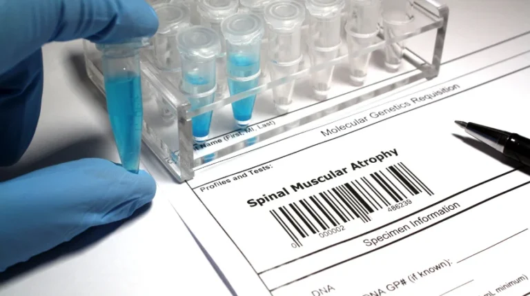 sma test