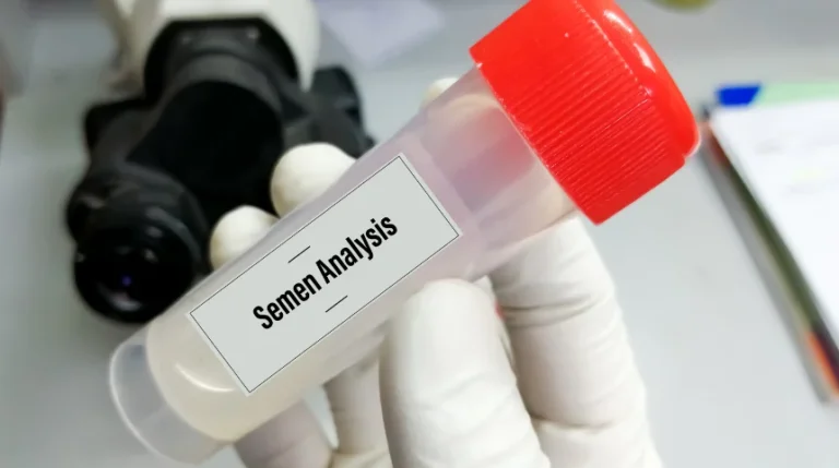 semen analysis test
