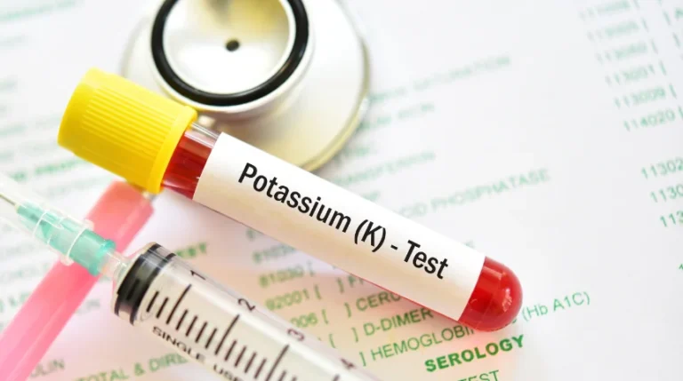 serum potassium test