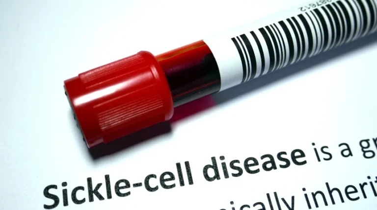 Sickle Cell Anemia Test | mediSuggest