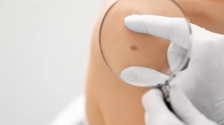 skin biopsy test