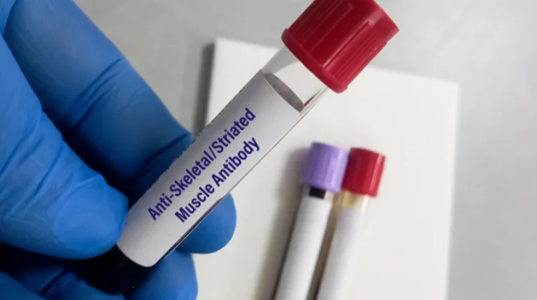 smooth muscle antibody test