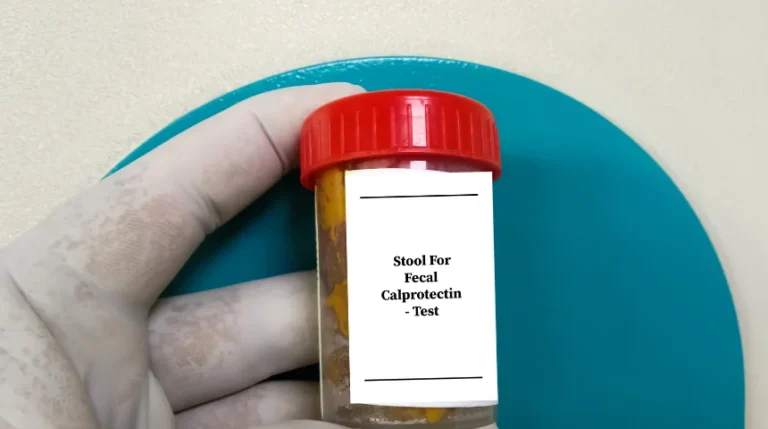stool dna test