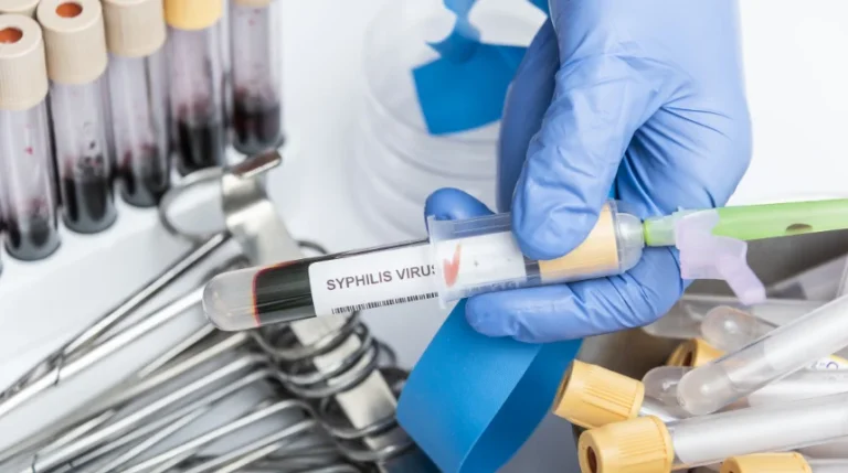syphilis test