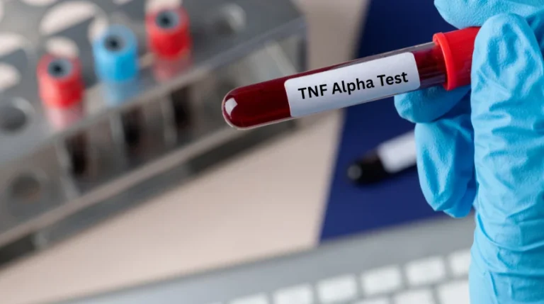 tnf alpha test