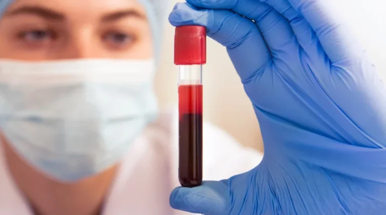 Thrombin Time Test | mediSuggest
