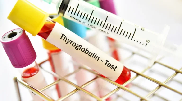 thyroglobulin test