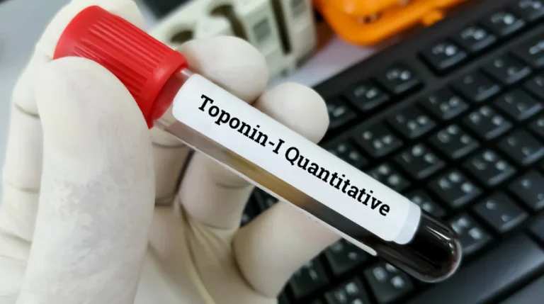 troponin t test