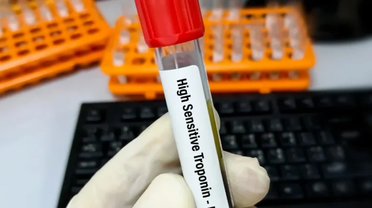 Troponin Test | mediSuggest